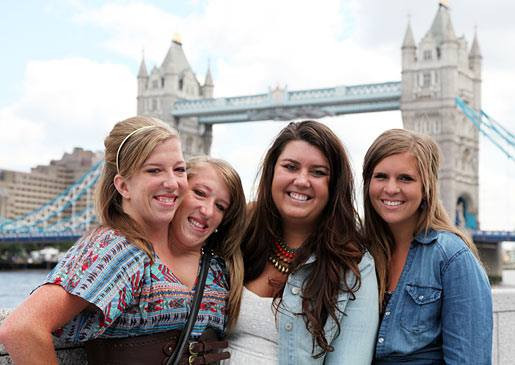 Tıp mucizesi siyam ikizleri Abby ve Brittany hayatlarının kararını verdi - Resim: 6