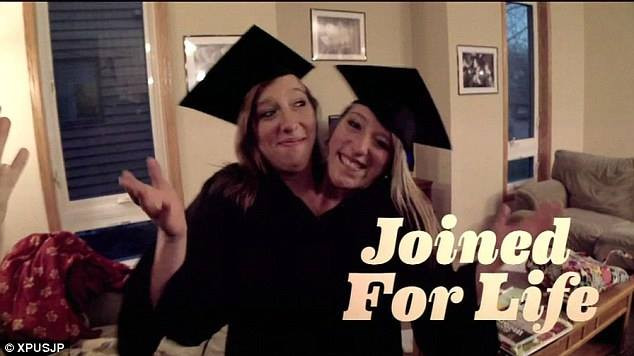 Tıp mucizesi siyam ikizleri Abby ve Brittany hayatlarının kararını verdi - Resim: 5