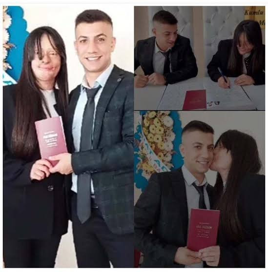 Berfin Özek, Yüzüne Kezzap Atan Sevgilisiyle Evlendi - Resim: 1