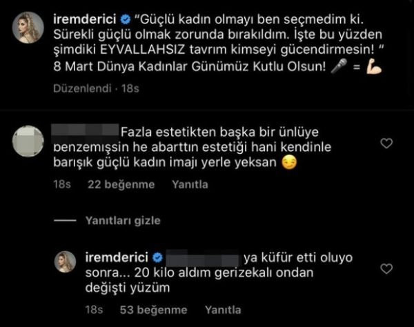 İrem Derici’den geri zekalı çıkışı - Resim: 1