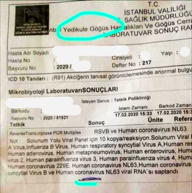 İstanbul’da Corona virüsü paniği! Bakan Koca’dan açıklama geldi - Resim: 2