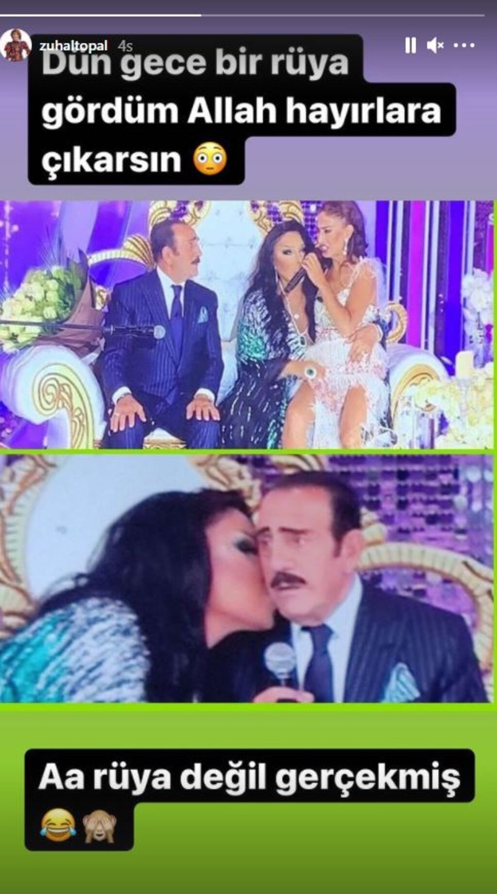 Zuhal Topal, Bülent Ersoy ile Dalga Geçti: Rüya Değilmiş! - Resim: 1