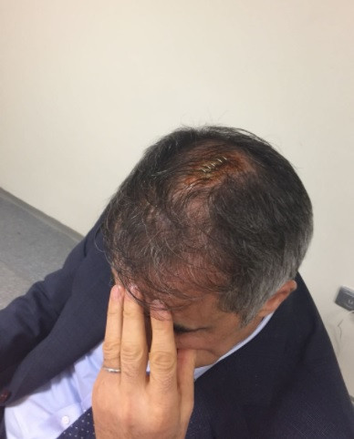 Sosyal medya ayakta! Şenol Güneş'in kafasına 5 dikiş - Resim: 2