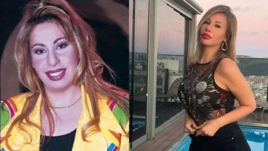 Şarkıcı Linet’in son hali, görenleri şaşırttı! - Resim: 1