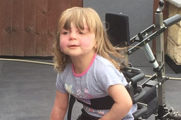 Çocuğun yüzündeki morlukların nedenini öğrendiklerinde yıkıldılar - Resim: 2