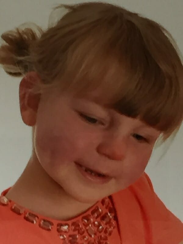 Çocuğun yüzündeki morlukların nedenini öğrendiklerinde yıkıldılar - Resim: 1