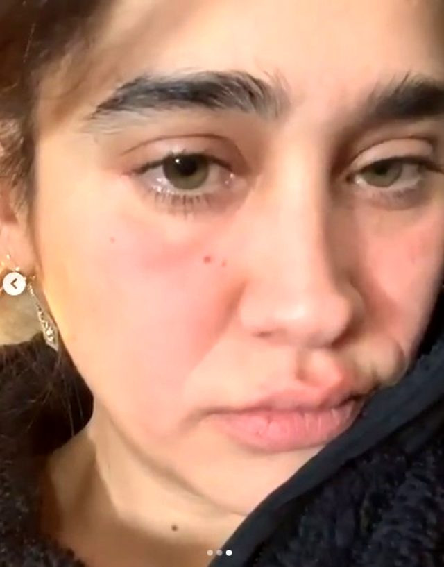 Meltem Miraloğlu hüzünlü halleriyle takipçilerini korkuttu - Resim: 1