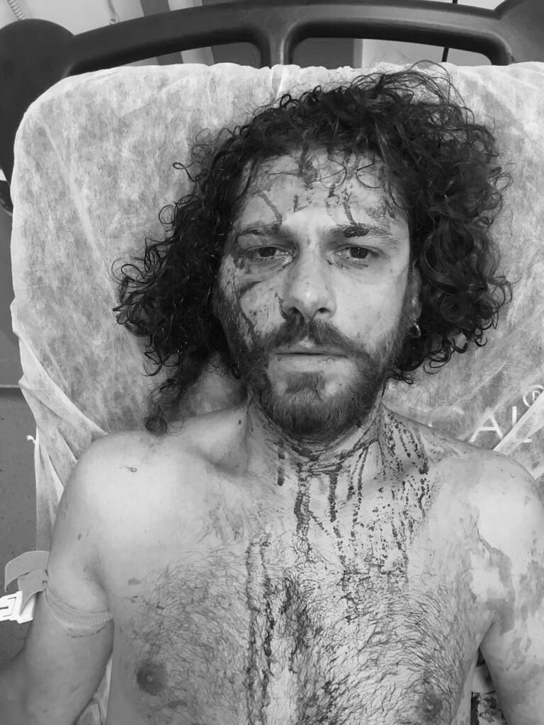 Kadıköy'deki saldırıda oyuncu Oral Özer'e ağır dayak - Resim: 3
