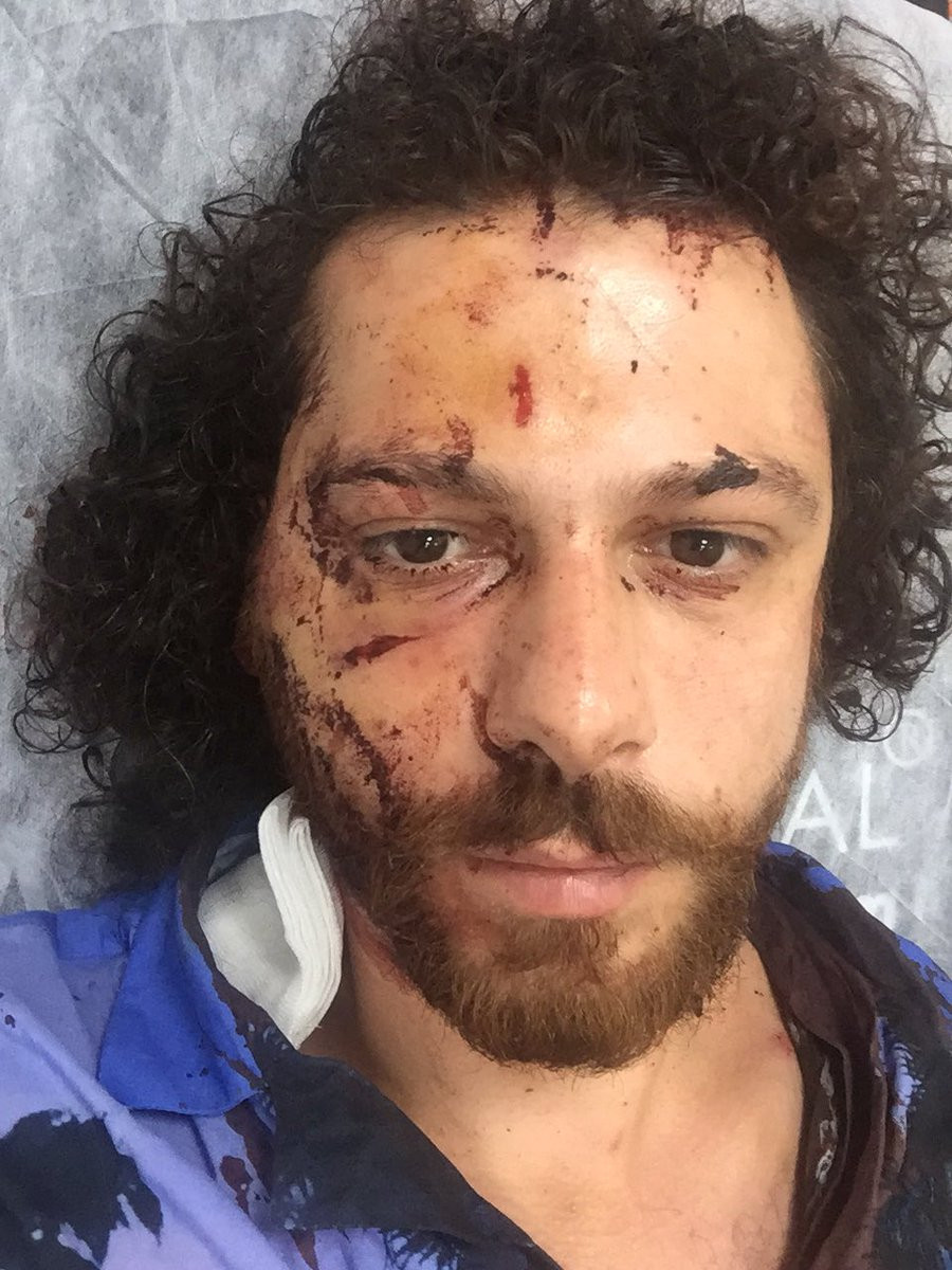 Kadıköy'deki saldırıda oyuncu Oral Özer'e ağır dayak - Resim: 2