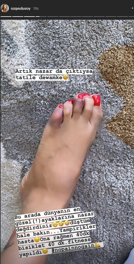 Özge Ulusoy'un ayaklarına nazar değdi! - Resim: 1