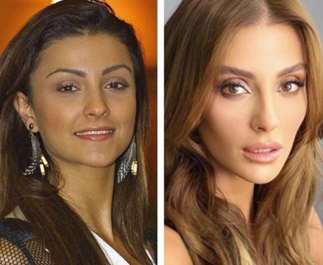 Özge Ulusoy'un zaman içindeki değişimi şaşkına çeviriyor - Resim: 1