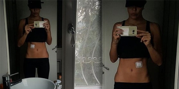 Şok! Deniz Akkaya'nın karnına demir saplandı! Durumu nasıl? - Resim: 1