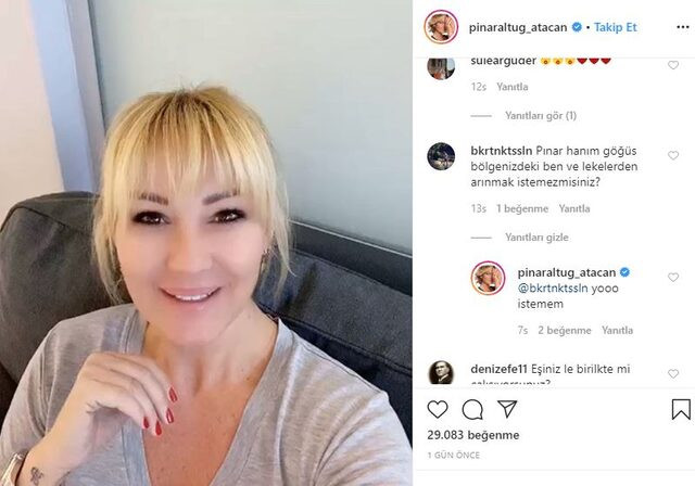 Pınar Altuğ'dan göğüs bölgesindeki benlere takılan takipçisine yanıt verdi - Resim: 1