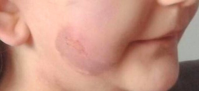 Babasının sevgilisi tarafından şiddet gören minik kızın kurtarılma hikayesi - Resim: 2