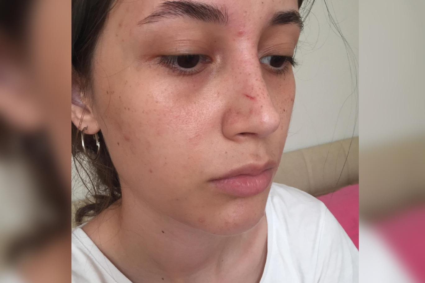 Mini Şortlu Genç Kıza Saldıran Sapık: Erkek Adamım Sinirlendim! - Resim: 1