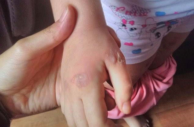 Babasının sevgilisi tarafından şiddet gören minik kızın kurtarılma hikayesi - Resim: 1