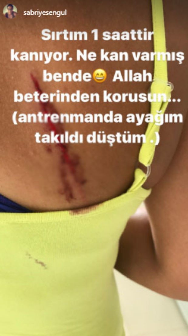 Survivor Sabriye sevenlerini korkuttu! Sırtı kanlar içinde kaldı... - Resim: 1