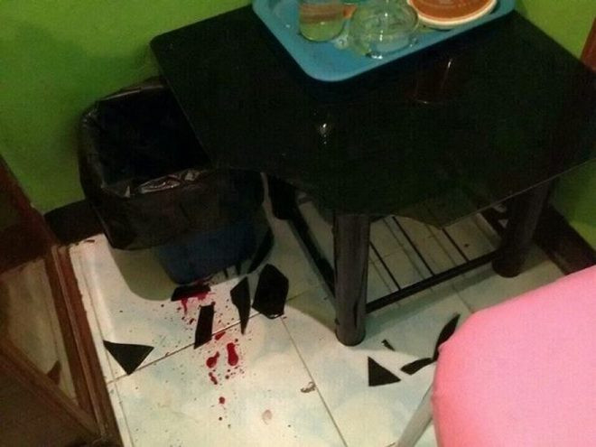 Cam sehpada seks fantezisi kanlı bitti! - Resim: 1