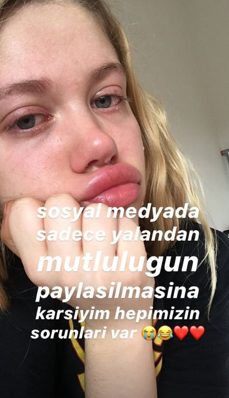 Bodrum Masalı ile tanınan Serel Yereli'nin fazla kiloları dikkat çekti - Resim: 1