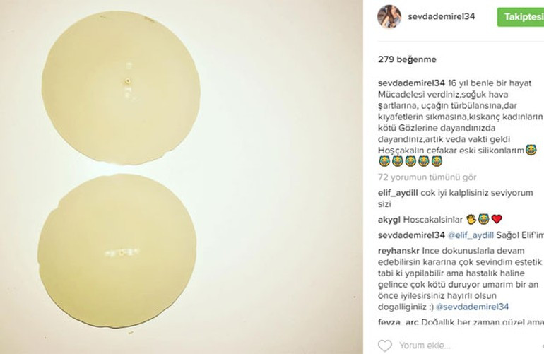 Sevda Demirel'den silikonlarına duygusal veda! Yıllarca kahrımı çektiniz.. - Resim: 1