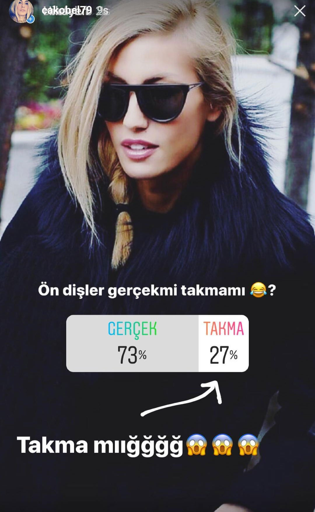 Çağla Şıkel'in ön dişleri takma mı? sorusu sosyal medyada olay oldu - Resim: 1