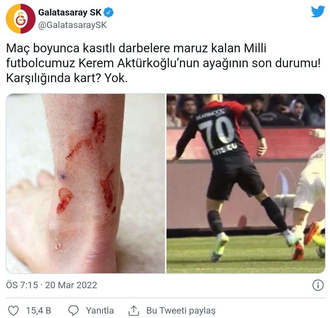 Galatasaray'dan Sert Kerem Aktürkoğlu Paylaşımı: Ayağının Son Durumu! - Resim: 1