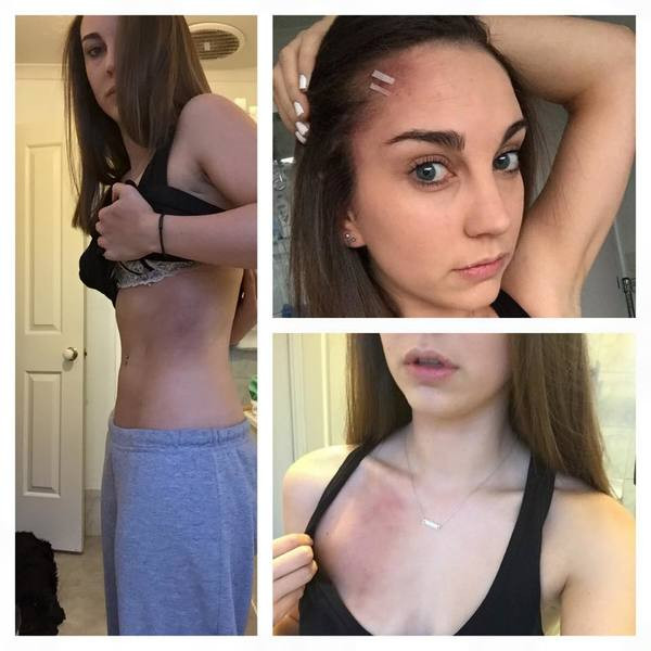 Genç kıza güpegündüz saldırdı, fakat bilmediği bir şey vardı - Resim: 1