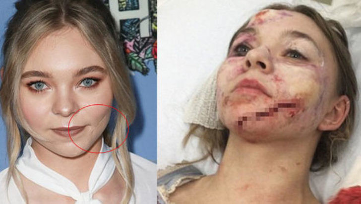 Genç oyuncu hayatının şokunu yaşadı! Sette korkunç kaza - Resim: 2