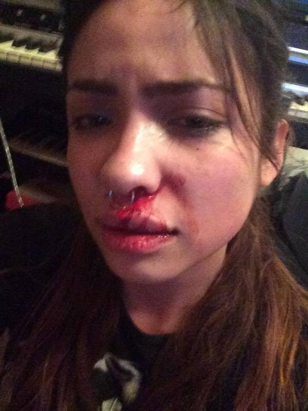 Ünlü Yıldız Tarafından Şiddete Uğradı - Yıldızın Kimliğini Açıklayınca Herkes Şaşırdı - Resim: 1