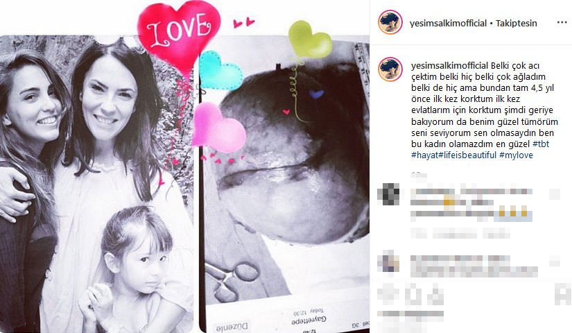 Yeşim Salkım: Benim güzel tümörüm, seni seviyorum - Resim: 1