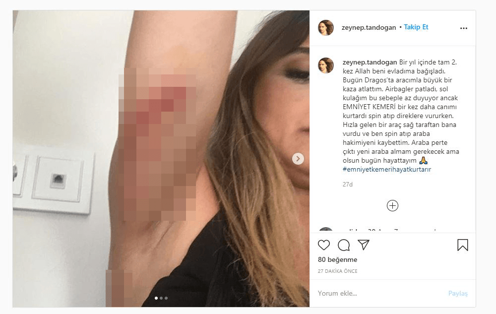 Ünlü sunucu Zeynep Tandoğan trafik kazası geçirdi - Resim: 1